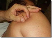 dry needling acupuncture